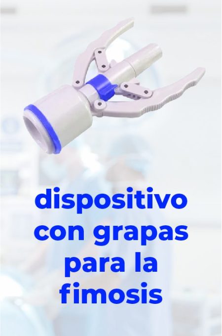operacion-fimosis sin bisturi